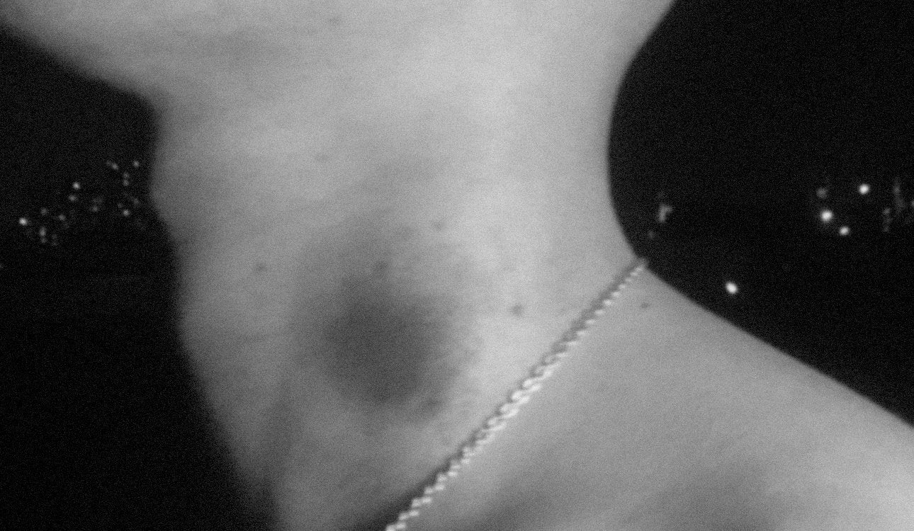 Neck